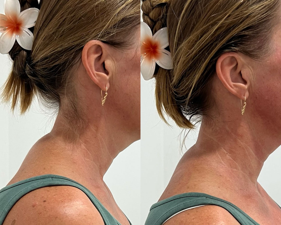 Cervicothoracic Manual Therapy